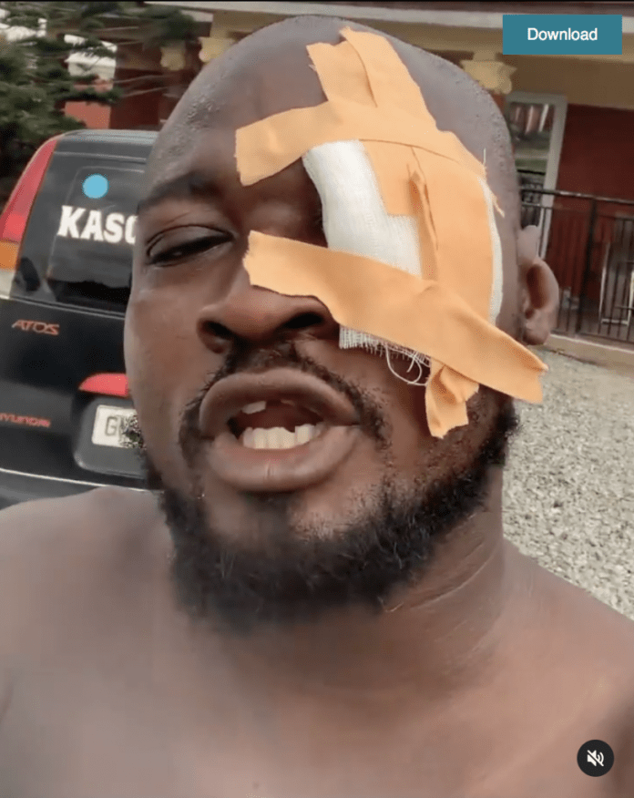 Funny Face Loses One Eye
