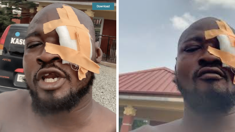 Funny Face Loses One Eye